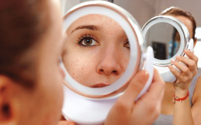 Set Yourself up for Clear Skin Success